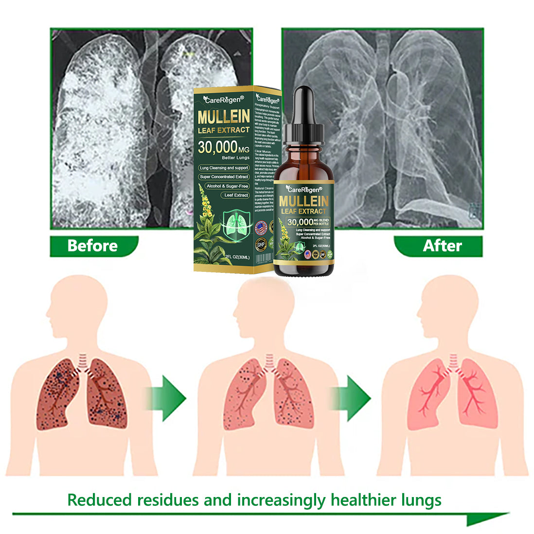 𝗢𝗳𝗳𝗶𝗰𝗶𝗮𝗹 𝗦𝘁𝗼𝗿𝗲:CareRegen®💙 𝗢𝗿𝗴𝗮𝗻𝗶𝗰 𝗟𝘂𝗻𝗴 𝗖𝗹𝗲𝗮𝗻𝘀𝗶𝗻𝗴 𝗠𝘂𝗹𝗹𝗲𝗶𝗻 𝗟𝗲𝗮𝗳 𝗘𝘅𝘁𝗿𝗮𝗰𝘁 𝗗𝗿𝗼𝗽𝘀  𝐂𝐥𝐢𝐧𝐢𝐜𝐚𝐥𝐥𝐲 𝐩𝐫𝐨𝐯𝐞𝐧, 𝐡𝐢𝐠𝐡𝐥𝐲 𝐜𝐨𝐧𝐜𝐞𝐧𝐭𝐫𝐚𝐭𝐞𝐝 𝐟𝐨𝐫𝐦𝐮𝐥𝐚 𝐭𝐡𝐚𝐭 𝐫𝐞𝐥𝐢𝐞𝐯𝐞𝐬 𝐜𝐨𝐮𝐠𝐡, 𝐩𝐡𝐥𝐞𝐠𝐦, 𝐚𝐬𝐭𝐡𝐦𝐚 & 𝐂𝐎𝐏𝐃 — 𝐛𝐫𝐞𝐚𝐭𝐡𝐞 𝐞𝐚𝐬𝐢𝐞𝐫, 𝐟𝐚𝐬𝐭𝐞𝐫 💙