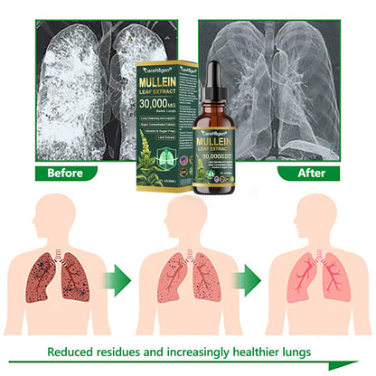 𝗢𝗳𝗳𝗶𝗰𝗶𝗮𝗹 𝗦𝘁𝗼𝗿𝗲:CareRegen®💙 𝗢𝗿𝗴𝗮𝗻𝗶𝗰 𝗟𝘂𝗻𝗴 𝗖𝗹𝗲𝗮𝗻𝘀𝗶𝗻𝗴 𝗠𝘂𝗹𝗹𝗲𝗶𝗻 𝗟𝗲𝗮𝗳 𝗘𝘅𝘁𝗿𝗮𝗰𝘁 𝗗𝗿𝗼𝗽𝘀  𝐂𝐥𝐢𝐧𝐢𝐜𝐚𝐥𝐥𝐲 𝐩𝐫𝐨𝐯𝐞𝐧, 𝐡𝐢𝐠𝐡𝐥𝐲 𝐜𝐨𝐧𝐜𝐞𝐧𝐭𝐫𝐚𝐭𝐞𝐝 𝐟𝐨𝐫𝐦𝐮𝐥𝐚 𝐭𝐡𝐚𝐭 𝐫𝐞𝐥𝐢𝐞𝐯𝐞𝐬 𝐜𝐨𝐮𝐠𝐡, 𝐩𝐡𝐥𝐞𝐠𝐦, 𝐚𝐬𝐭𝐡𝐦𝐚 & 𝐂𝐎𝐏𝐃 — 𝐛𝐫𝐞𝐚𝐭𝐡𝐞 𝐞𝐚𝐬𝐢𝐞𝐫, 𝐟𝐚𝐬𝐭𝐞𝐫 💙