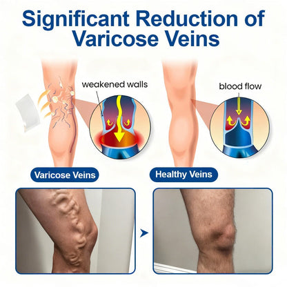🇺🇸👨‍⚕️👍✅Healrize® VeinTarget Microneedle Patch⚡Instant Relief, Long-Term Results💜