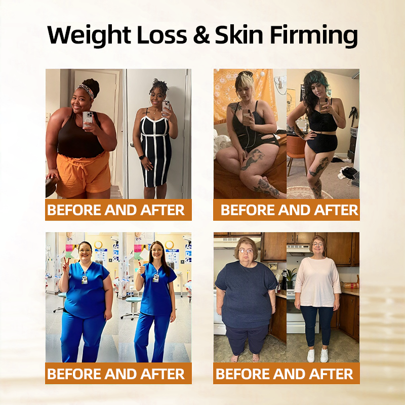 𝑶𝒇𝒇𝒊𝒄𝒊𝒂𝒍 𝑺𝒕𝒐𝒓𝒆  | 👩‍⚕️ H𝐞a𝐥r𝐢z𝐞®Moringa Berberine 10-in-1 Microgranule Body-Shaping Fat-Burning Patch(𝐎𝐧𝐜𝐞 𝐃𝐚𝐢𝐥𝐲, 𝐯𝐢𝐬𝐢𝐛𝐥𝐞 𝐜𝐡𝐚𝐧𝐠𝐞𝐬 𝐢𝐧 𝟕 𝐝𝐚𝐲𝐬） F𝐨r 𝐎𝐛𝐞𝐬𝐢𝐭𝐲, 𝐋o𝐨s𝐞 𝐒k𝐢n, 𝐃𝐢𝐚𝐛𝐞𝐭𝐞𝐬, 𝐒𝐥𝐞𝐞𝐩 𝐀𝐩𝐧𝐞𝐚, 𝐀𝐧𝐝 𝐉𝐨𝐢𝐧𝐭 𝐈𝐬𝐬𝐮𝐞𝐬💯