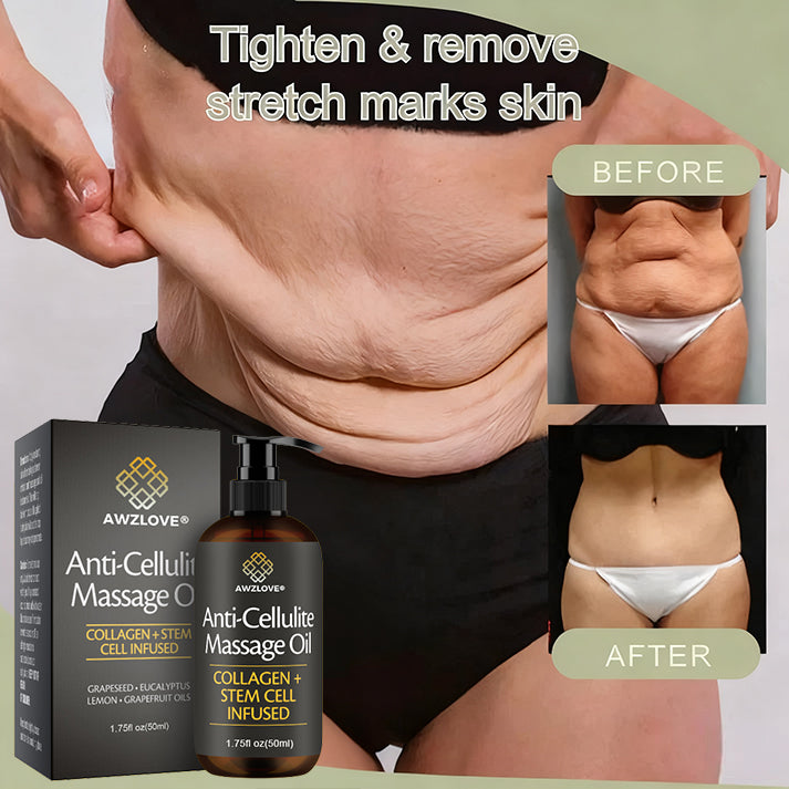 Awzlove® Luxurious Collagen & Stem Cell Anti-Cellulite Massage Oil🎉 (🔥80% Off for a Limited Time!) 💜