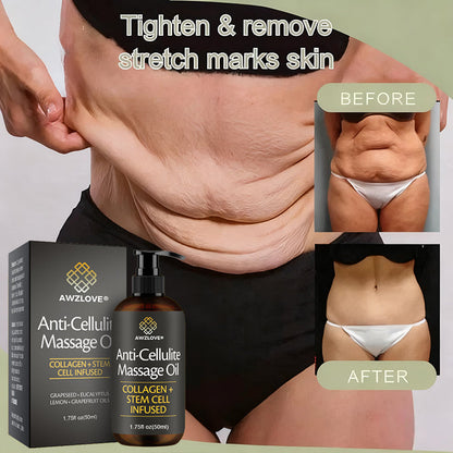 Awzlove® Luxurious Collagen & Stem Cell Anti-Cellulite Massage Oil🎉 (🔥80% Off for a Limited Time!) 💜