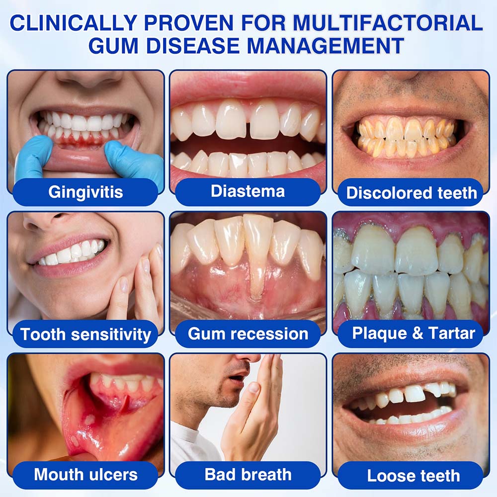 Healrize® GumRevive Periodontal Repair Gel (for bleeding gums, receding gums, and loose teeth) 🦷✨