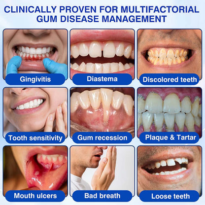 Healrize® GumRevive Periodontal Repair Gel (for bleeding gums, receding gums, and loose teeth) 🦷✨