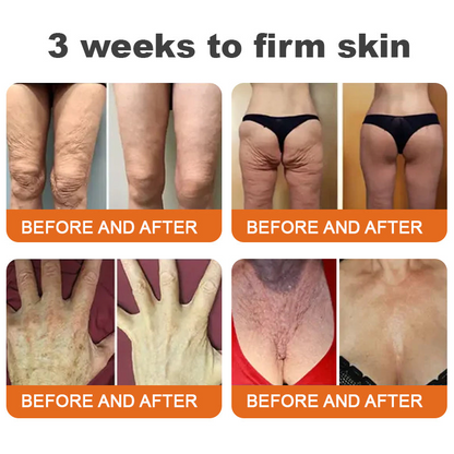 Awzlove® Luxurious Collagen & Stem Cell Anti-Cellulite Massage Oil🎉 (🔥80% Off for a Limited Time!) 💜