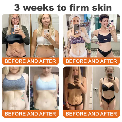 Awzlove® Luxurious Collagen & Stem Cell Anti-Cellulite Massage Oil🎉 (🔥80% Off for a Limited Time!) 💜