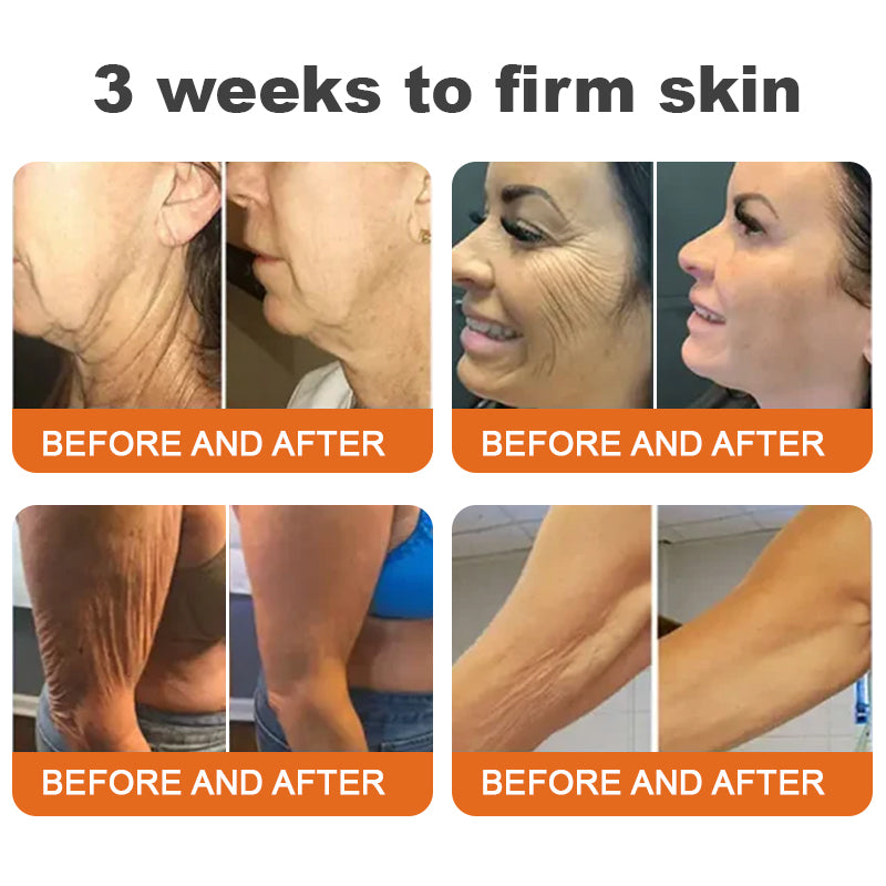 Awzlove® Luxurious Collagen & Stem Cell Anti-Cellulite Massage Oil🎉 (🔥80% Off for a Limited Time!) 💜
