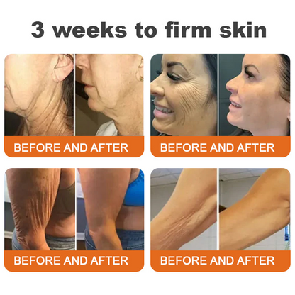Awzlove® Luxurious Collagen & Stem Cell Anti-Cellulite Massage Oil🎉 (🔥80% Off for a Limited Time!) 💜